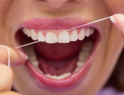 Most common myths about flossing