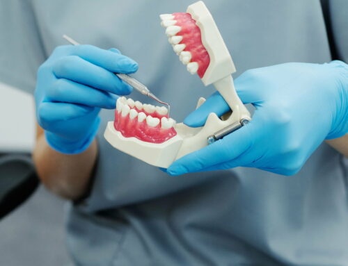Benefits of dental charting