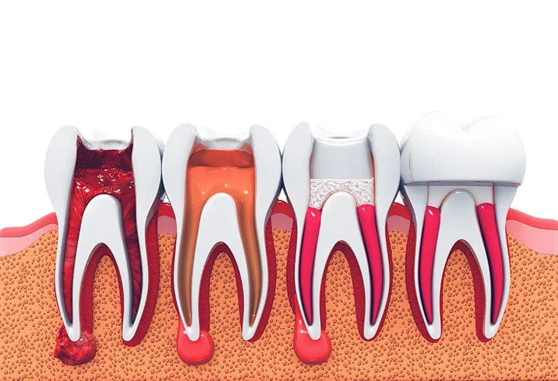 Dental Treatments: TOP 10 Most Common Dental Procedures