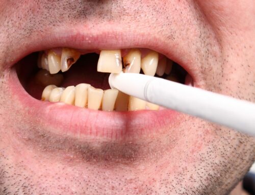 The link between smoking and oral health problems