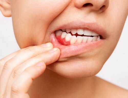 How to keep your gums healthy