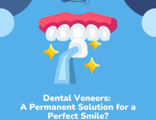 Dental Veneers: A Permanent Solution for a Perfect Smile?