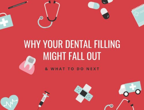 Why Your Dental Filling Might Fall Out & What to Do Next