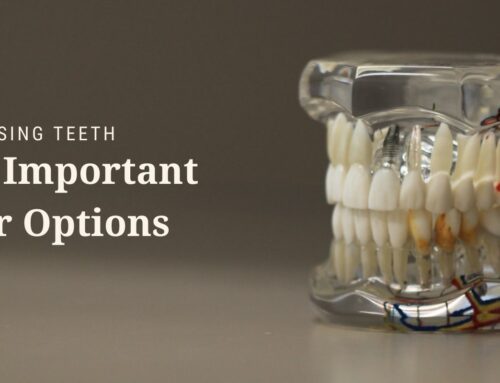 Replacing Missing Teeth: Why It’s Important and Your Options