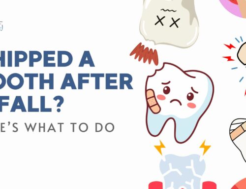 Chipped a Tooth After a Fall? Here’s What Actually Matters
