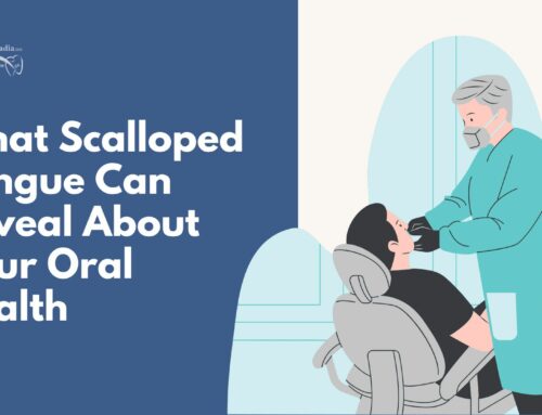 What Scalloped Tongue Can Reveal About Your Oral Health