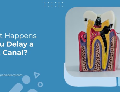 What Happens If You Delay a Root Canal?