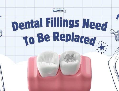 Why Do Dental Fillings Need to Be Replaced