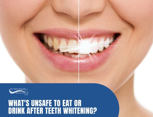 What’s Unsafe to Eat or Drink After Teeth Whitening?