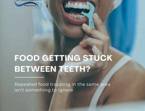 Why Does Food Keep Getting Stuck Between My Teeth?