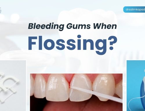 Why Do My Gums Bleed Only When I Floss?