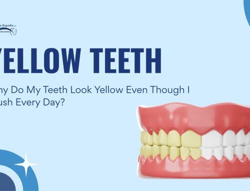 Why Do My Teeth Look Yellow Even Though I Brush Every Day?