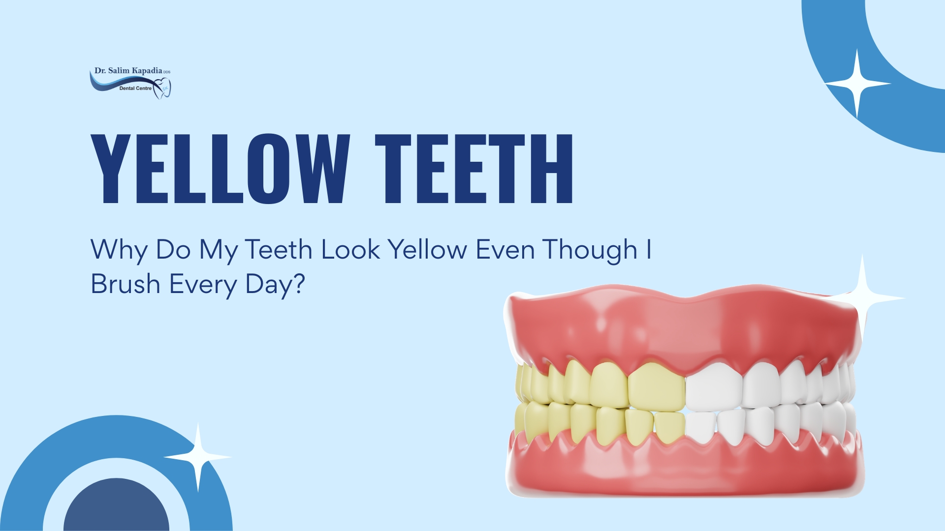 Why Do My Teeth Look Yellow Even Though I Brush Every Day